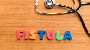 Fístulas Anales: Qué Son, Cómo Se Curan y Cuándo Acudir al Especialista